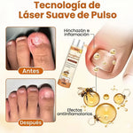 🐝FUNGI BEE - SPRAY ANTI-HONGOS CON VENENO DE ABEJA🐝 + ENVÍO GRATIS